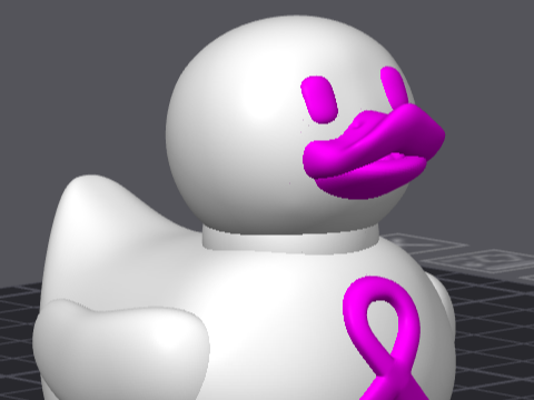 breast cancer