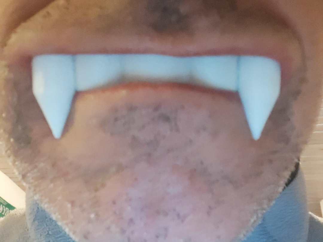 Vampirzähne