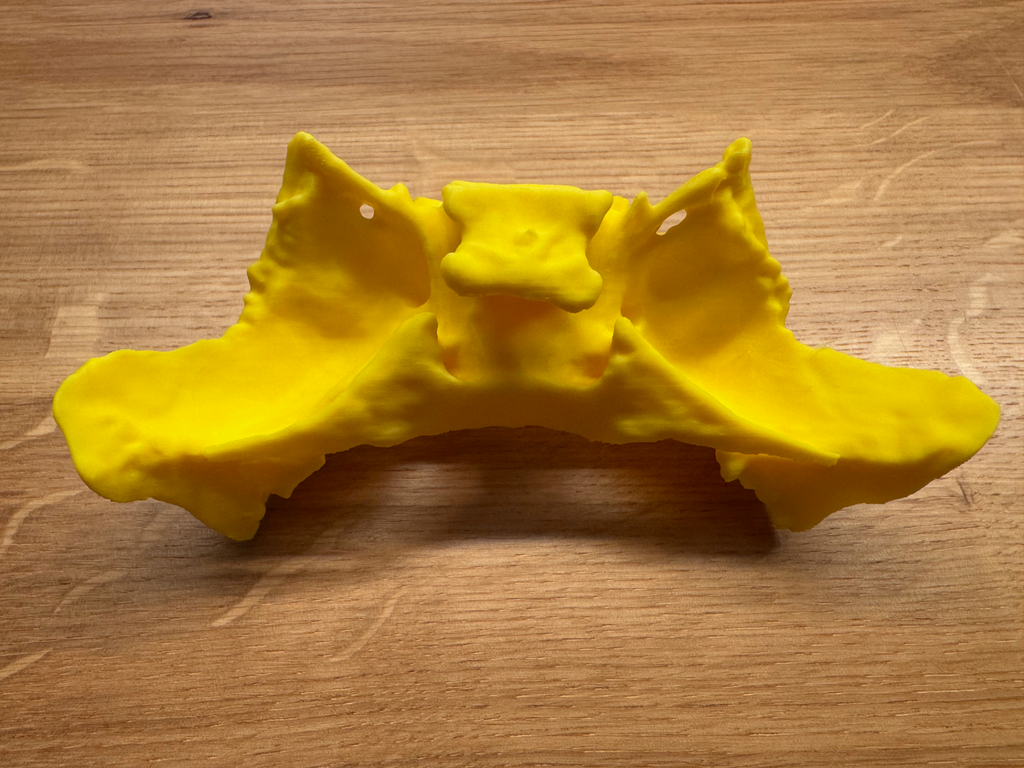 Human Sphenoid Bone