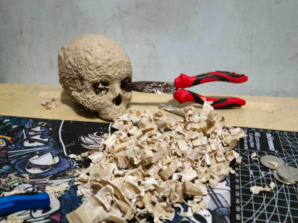 Aggressive Bone Cancer of the Skull
