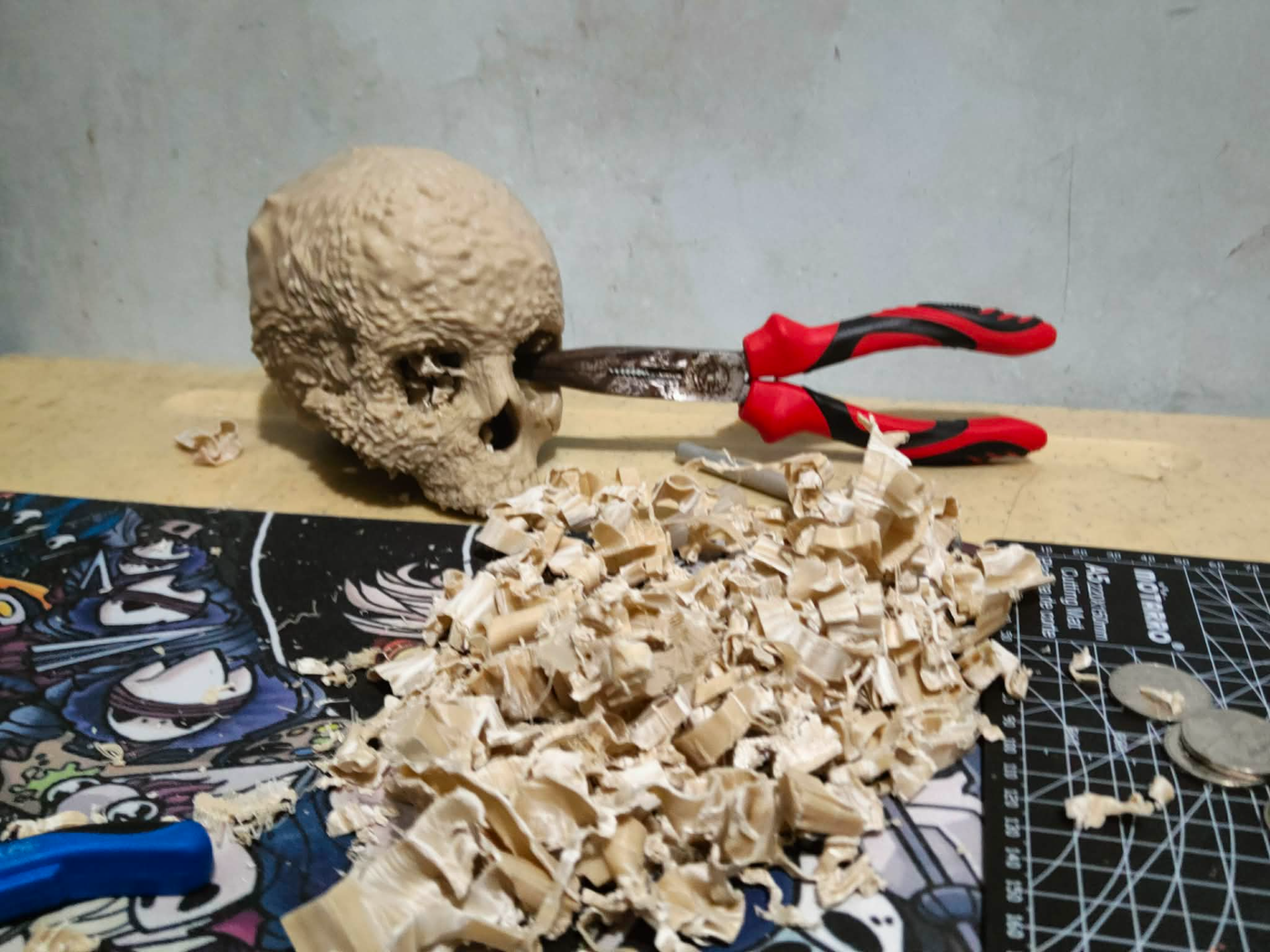 Aggressive Bone Cancer of the Skull