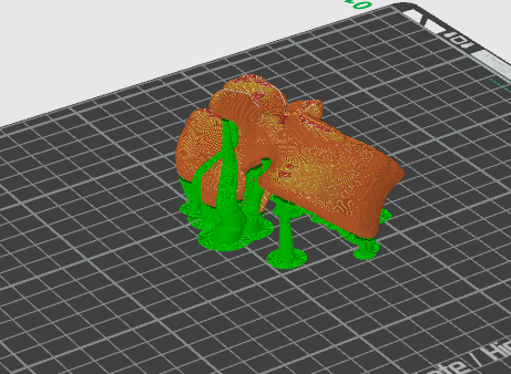 Lumbar Vertebrae