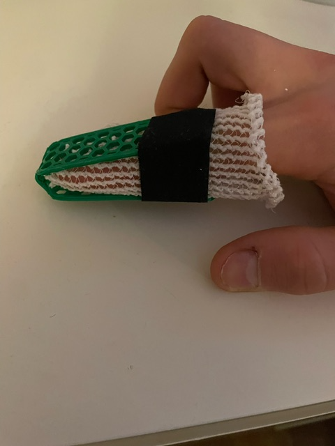 Broken Finger Split