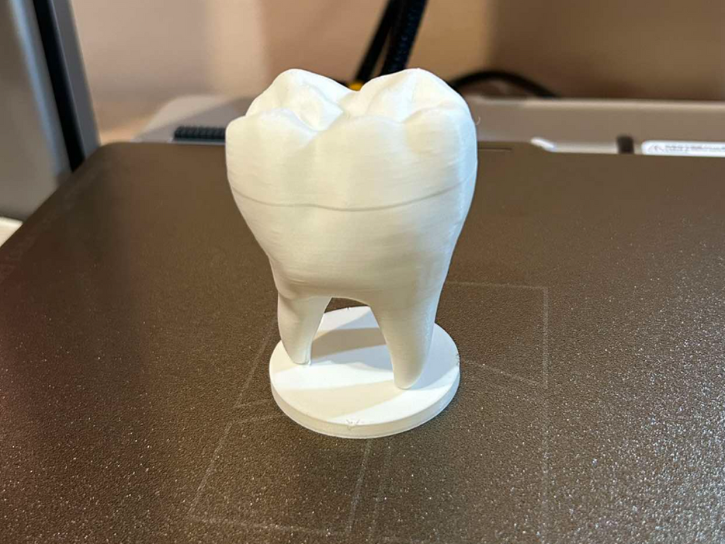 Toothbox, added supports, 0.2mm heigh