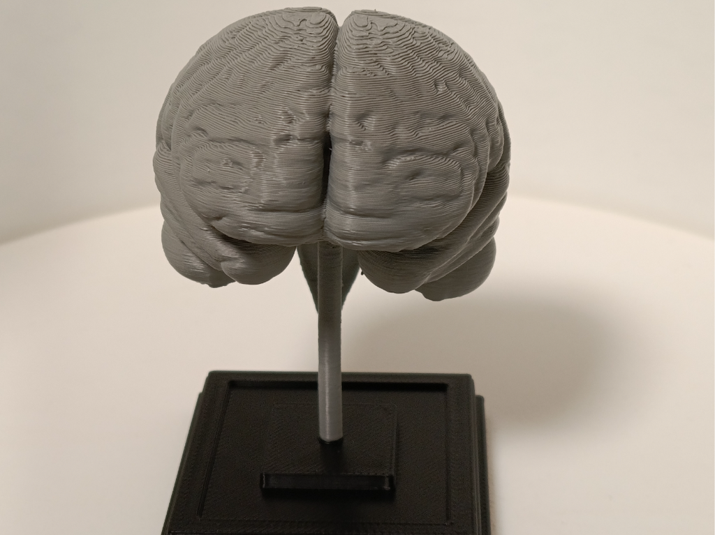 Brain on a stand