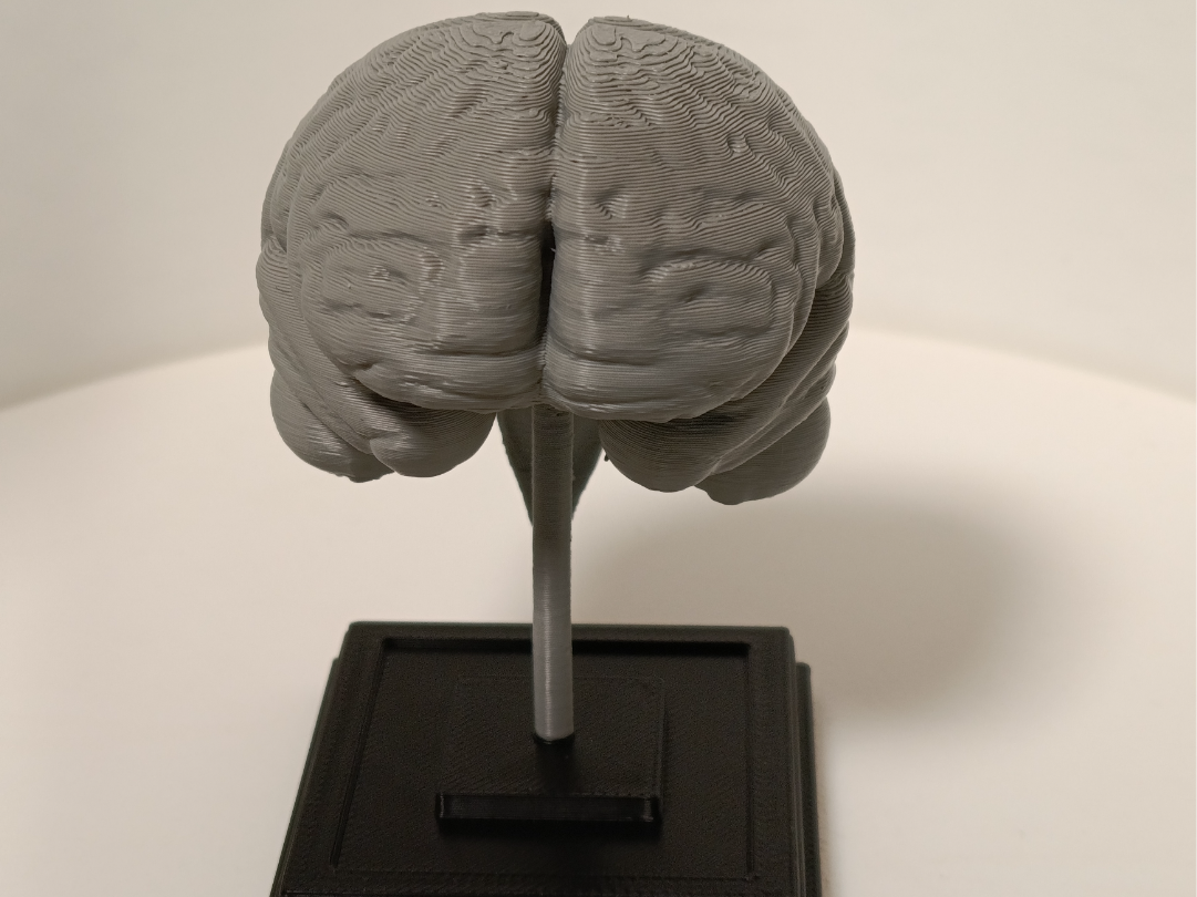 Brain on a stand