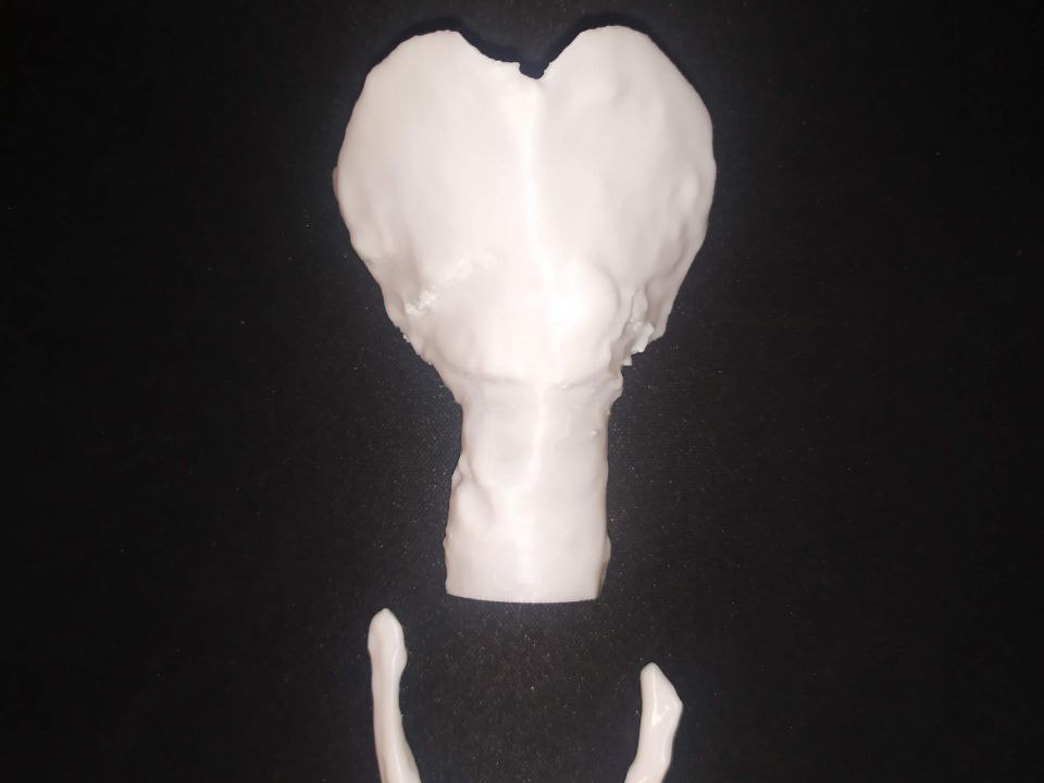 trachea and hyoide segmentation real anatomy