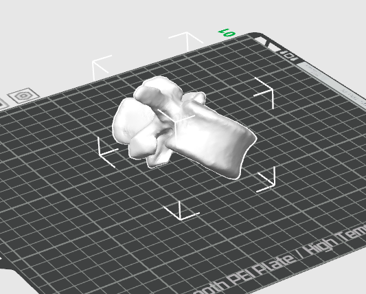 Lumbar Vertebrae