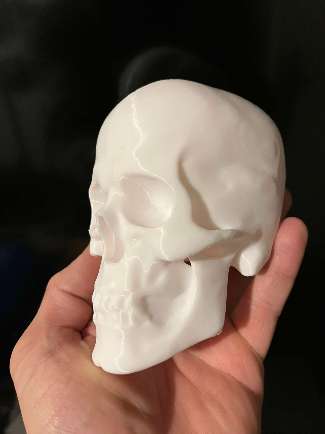 Human skull