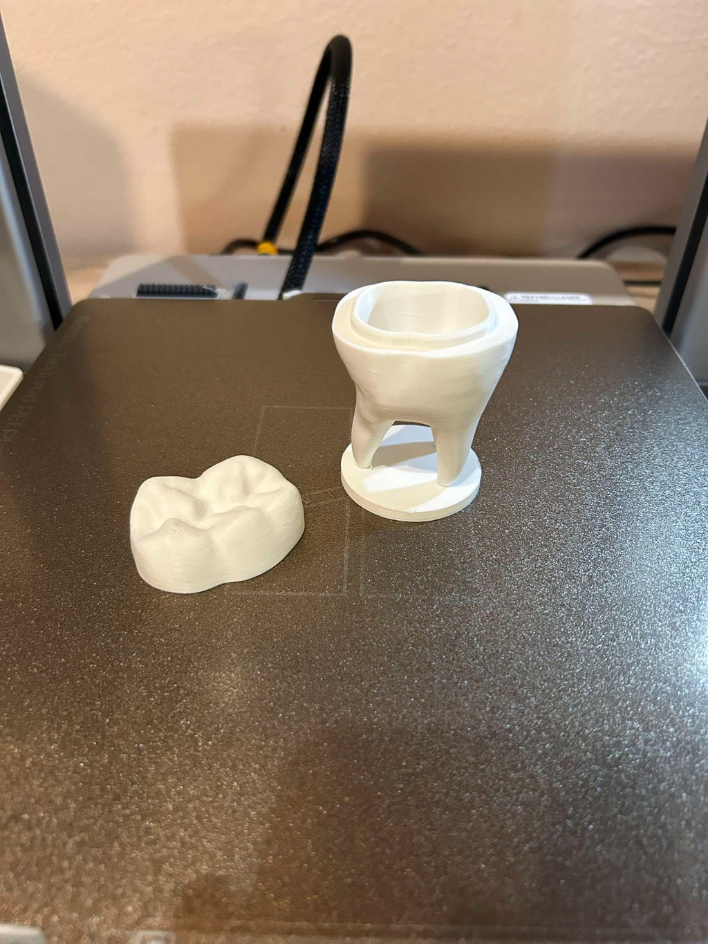 Toothbox, added supports, 0.2mm heigh