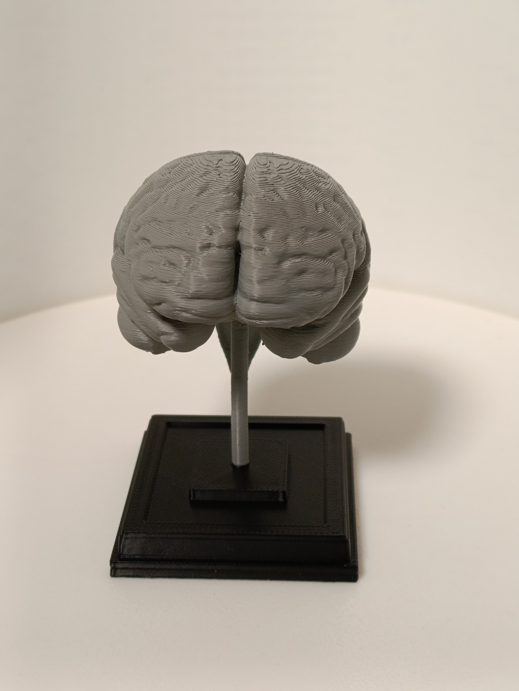 Brain on a stand