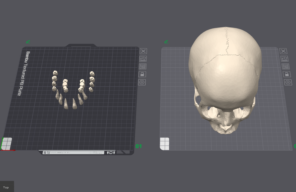 Skull with separate teeth