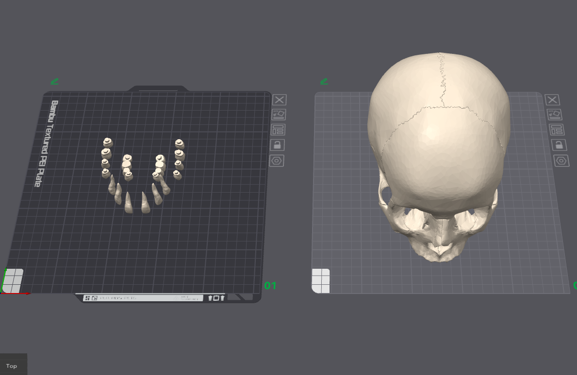 Skull with separate teeth
