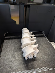 A real creepy lumbar spine
