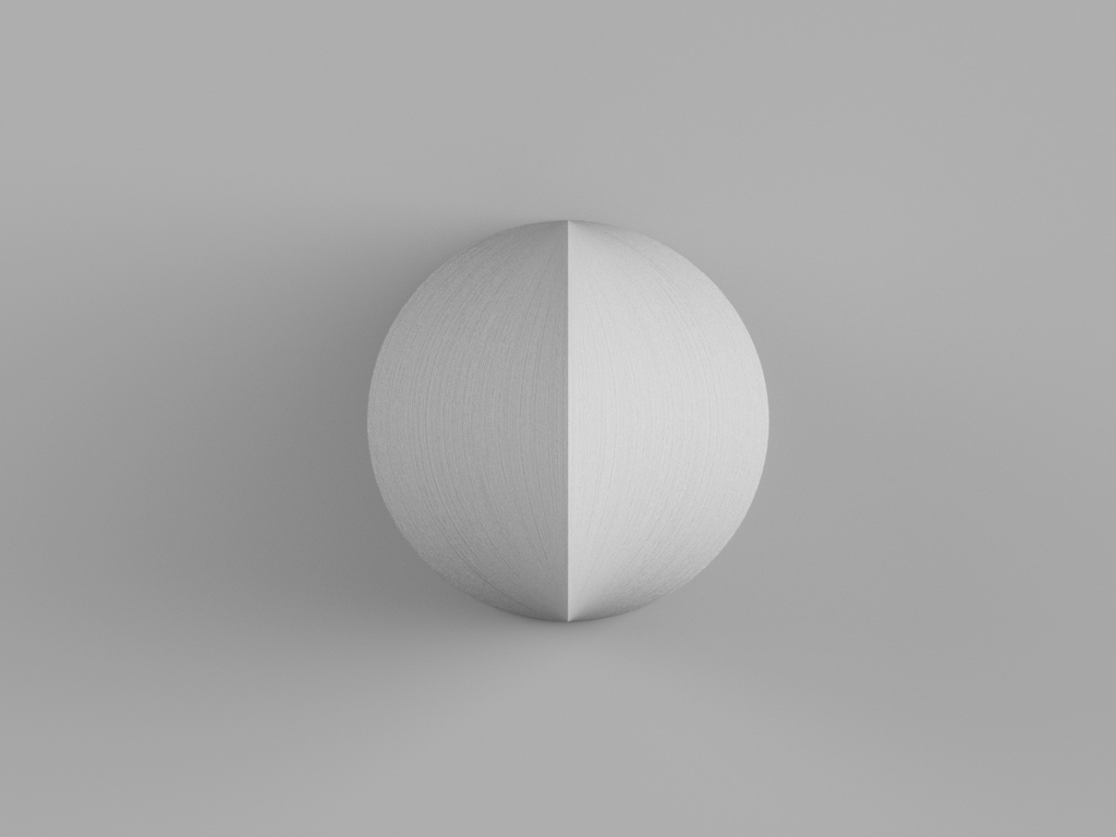 Right Conoid
