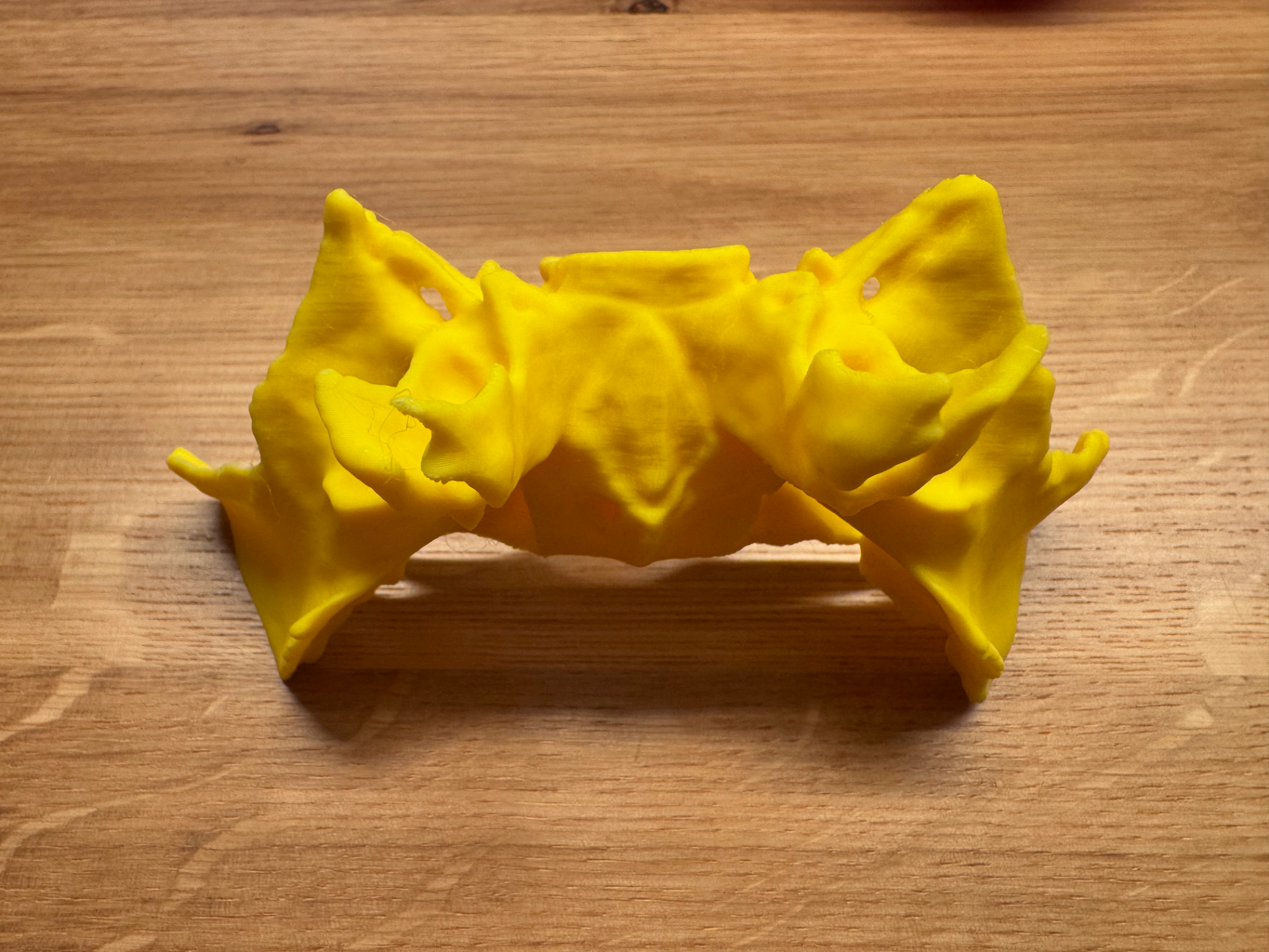Human Sphenoid Bone