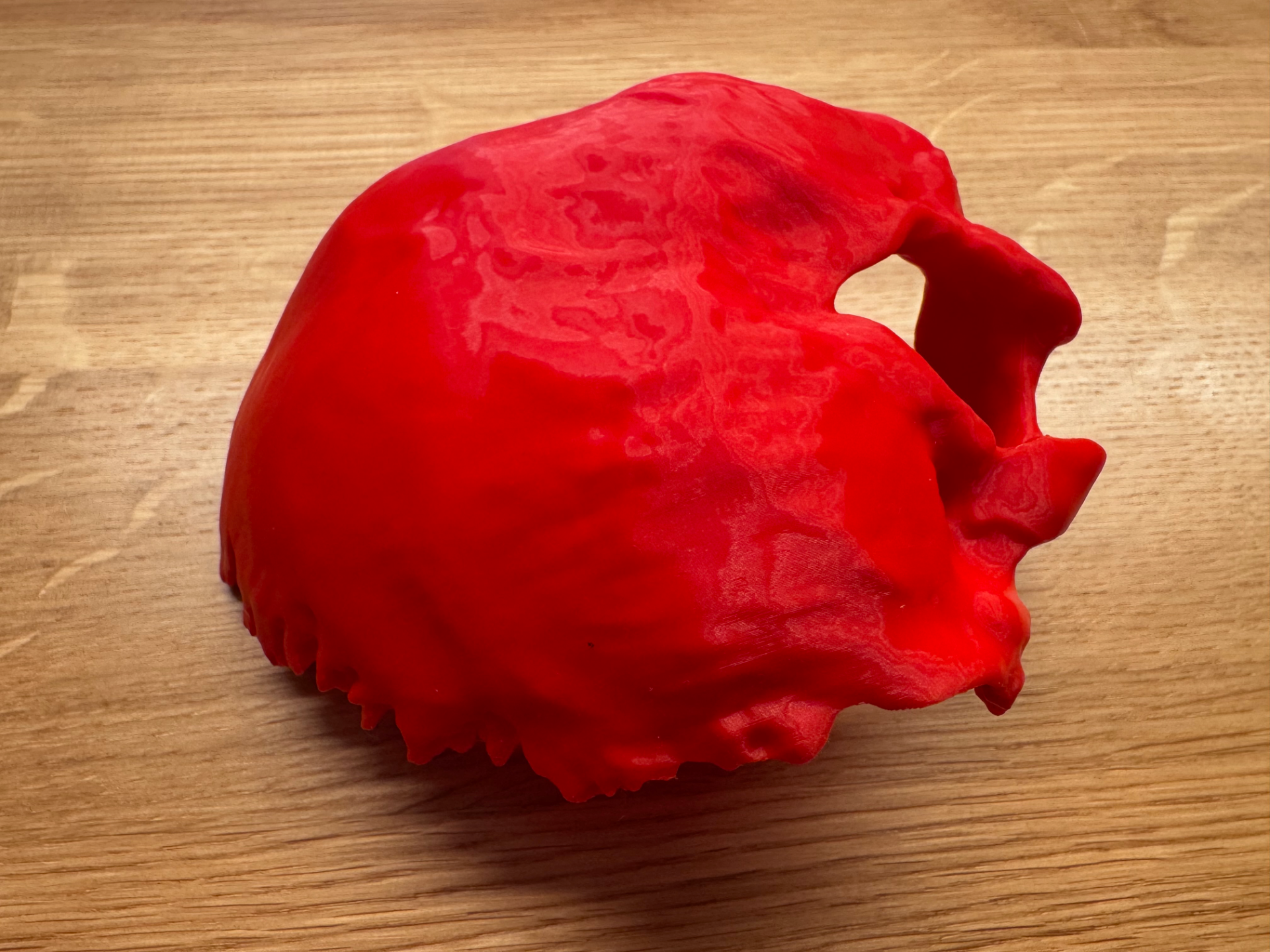 Human Occipital Bone