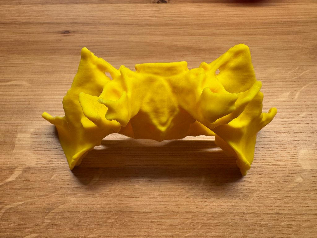 Human Sphenoid Bone