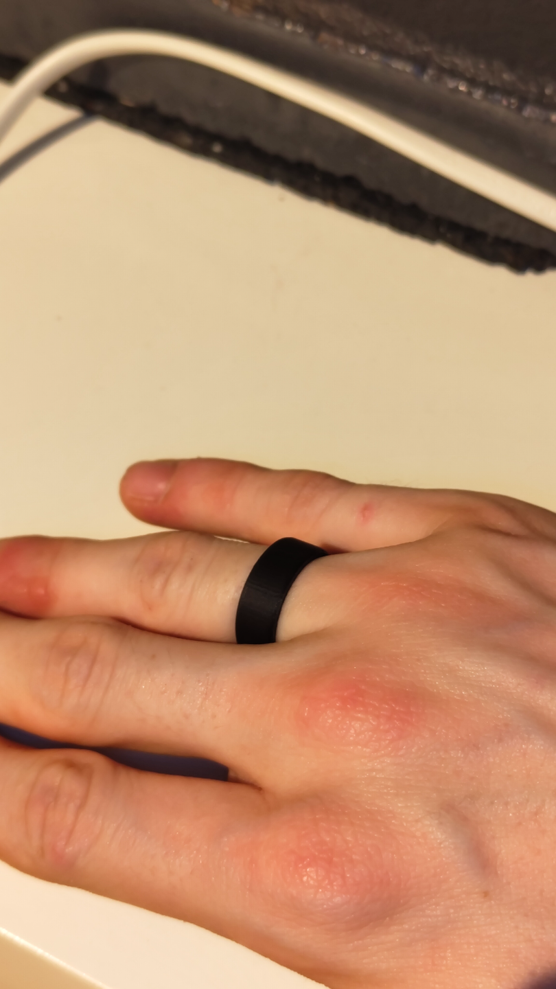 Simple Ring
