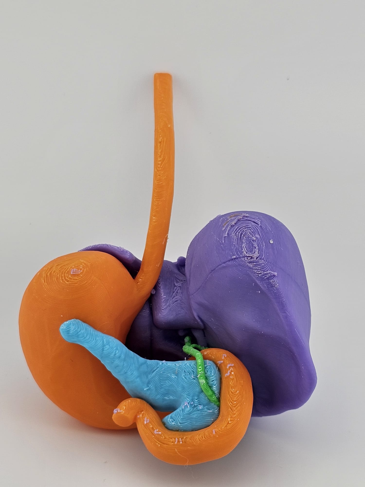 4-Color Anatomy: Upper Gastrointestinal Tract