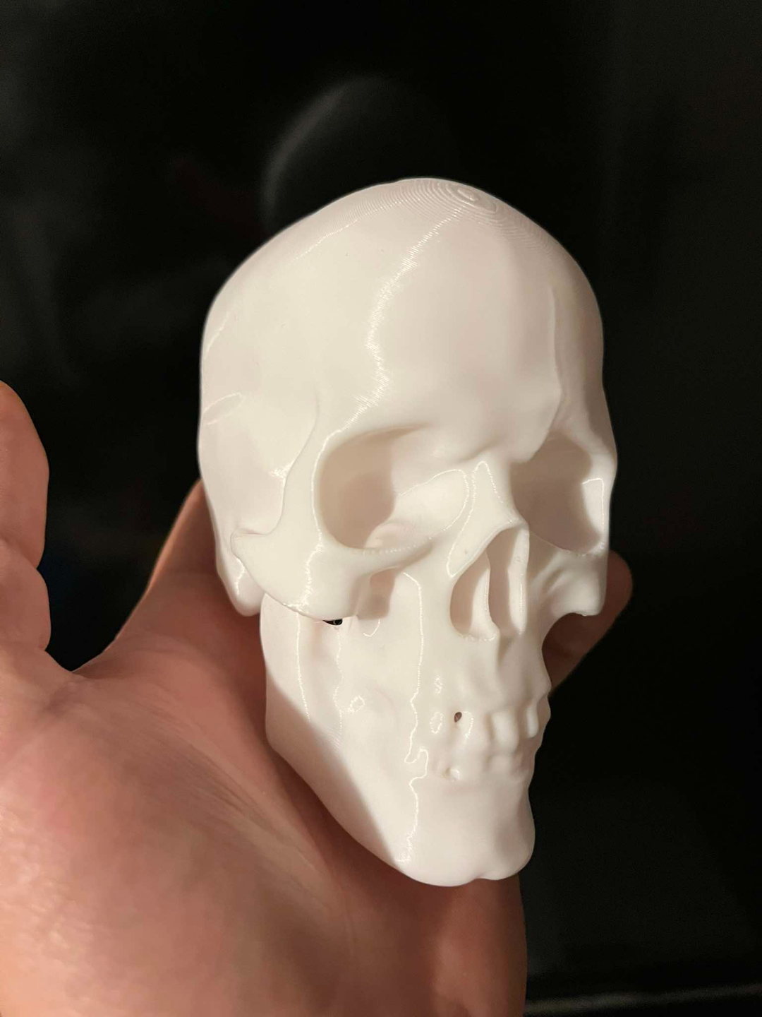 Human skull