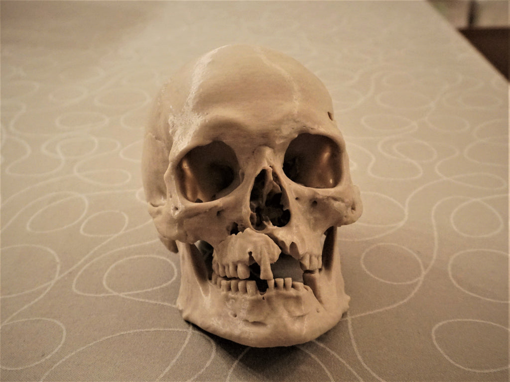 Battle of Visby Human Skull Replica (Historical Museum Scan)