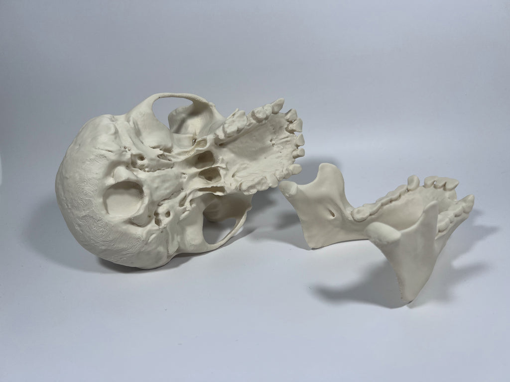 Adult Female Chimpanzee Cranium and Mandible