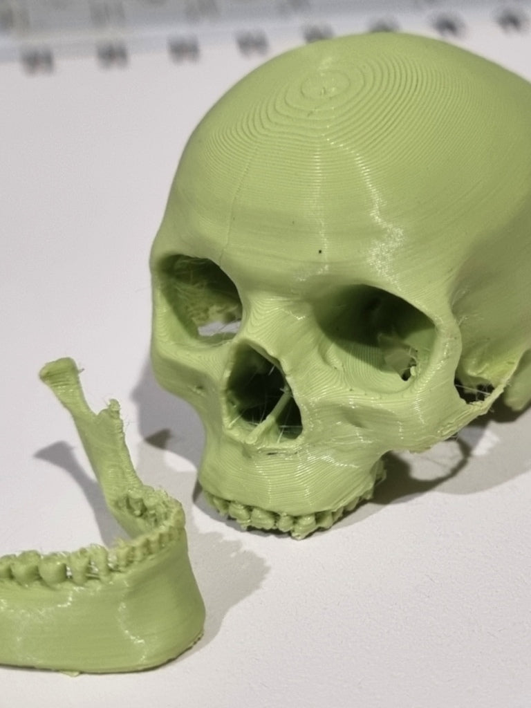 Skull