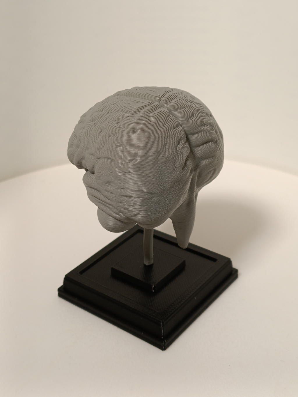 Brain on a stand