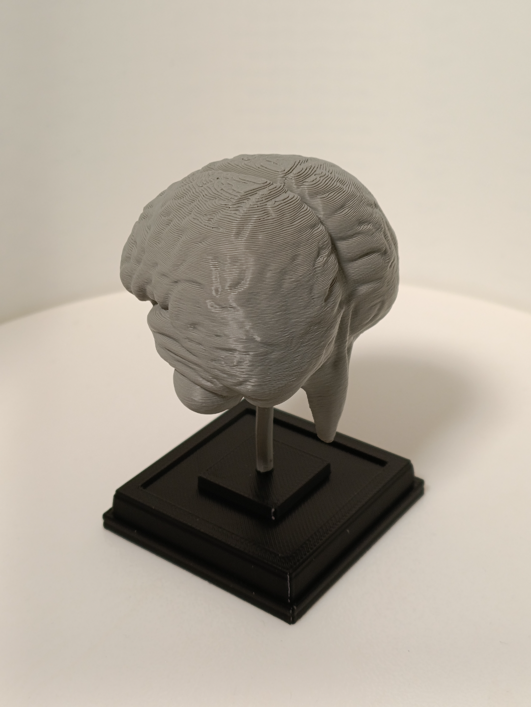 Brain on a stand