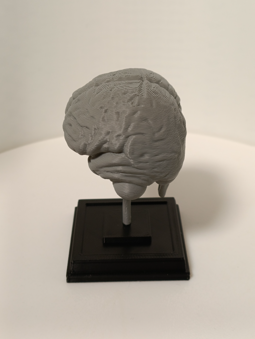 Brain on a stand