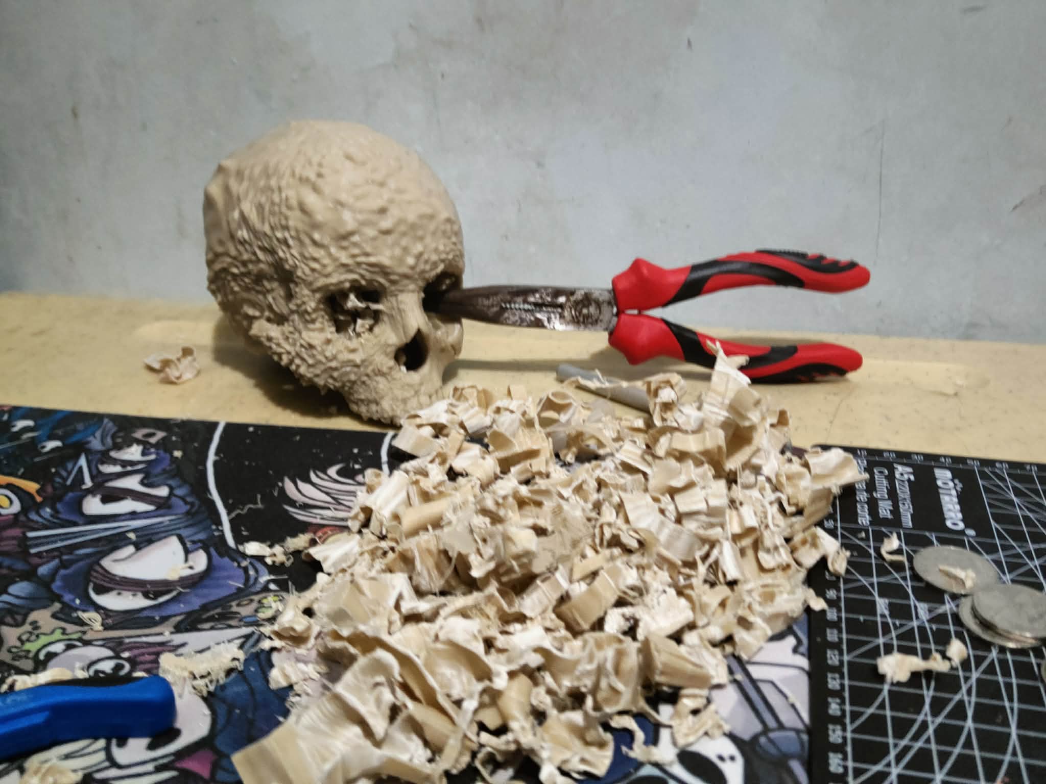 Aggressive Bone Cancer of the Skull