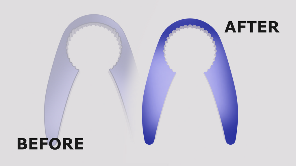 Plastic bottle opener