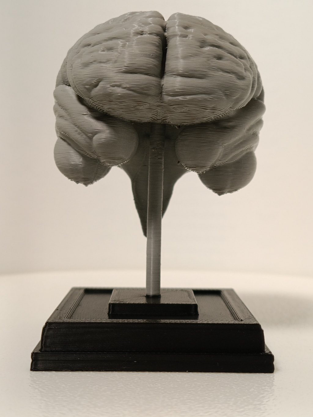 Brain on a stand