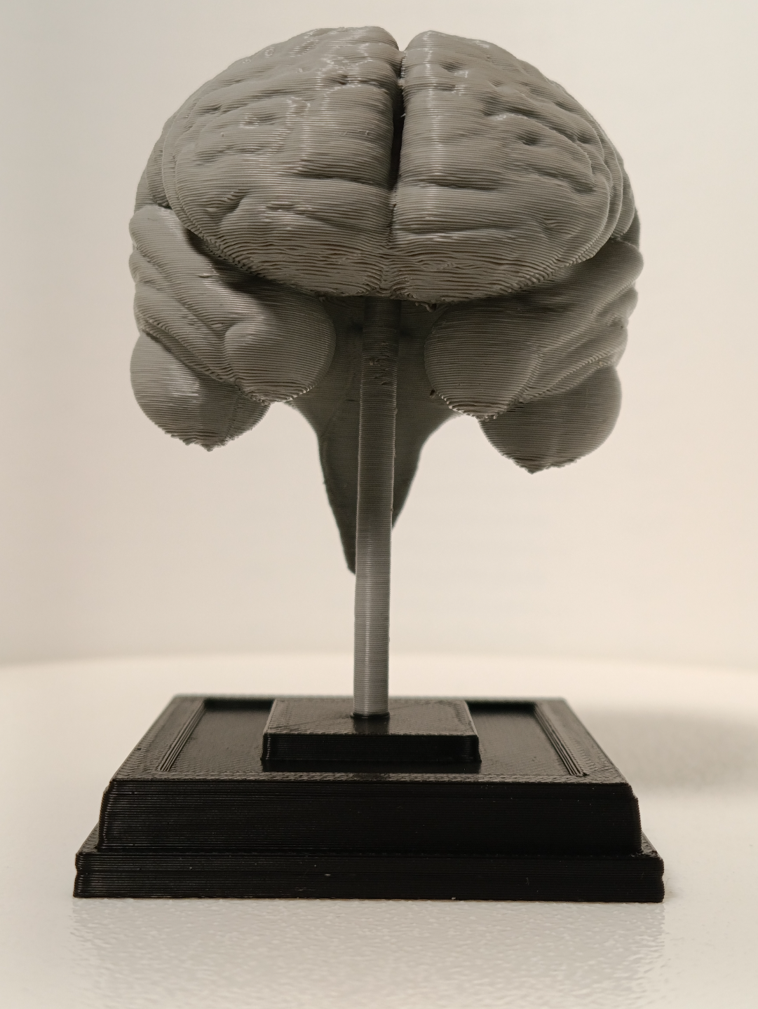 Brain on a stand