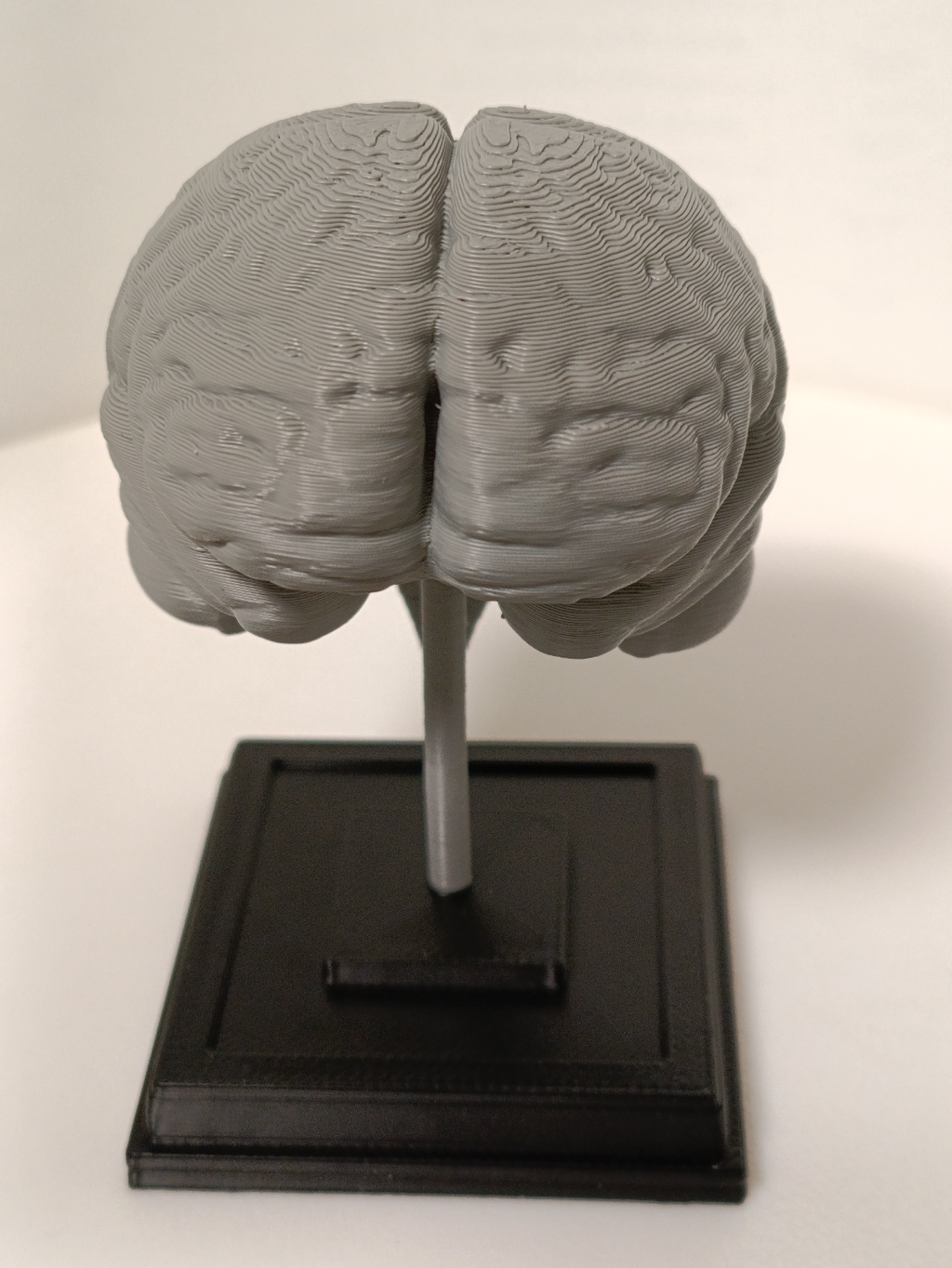 Brain on a stand