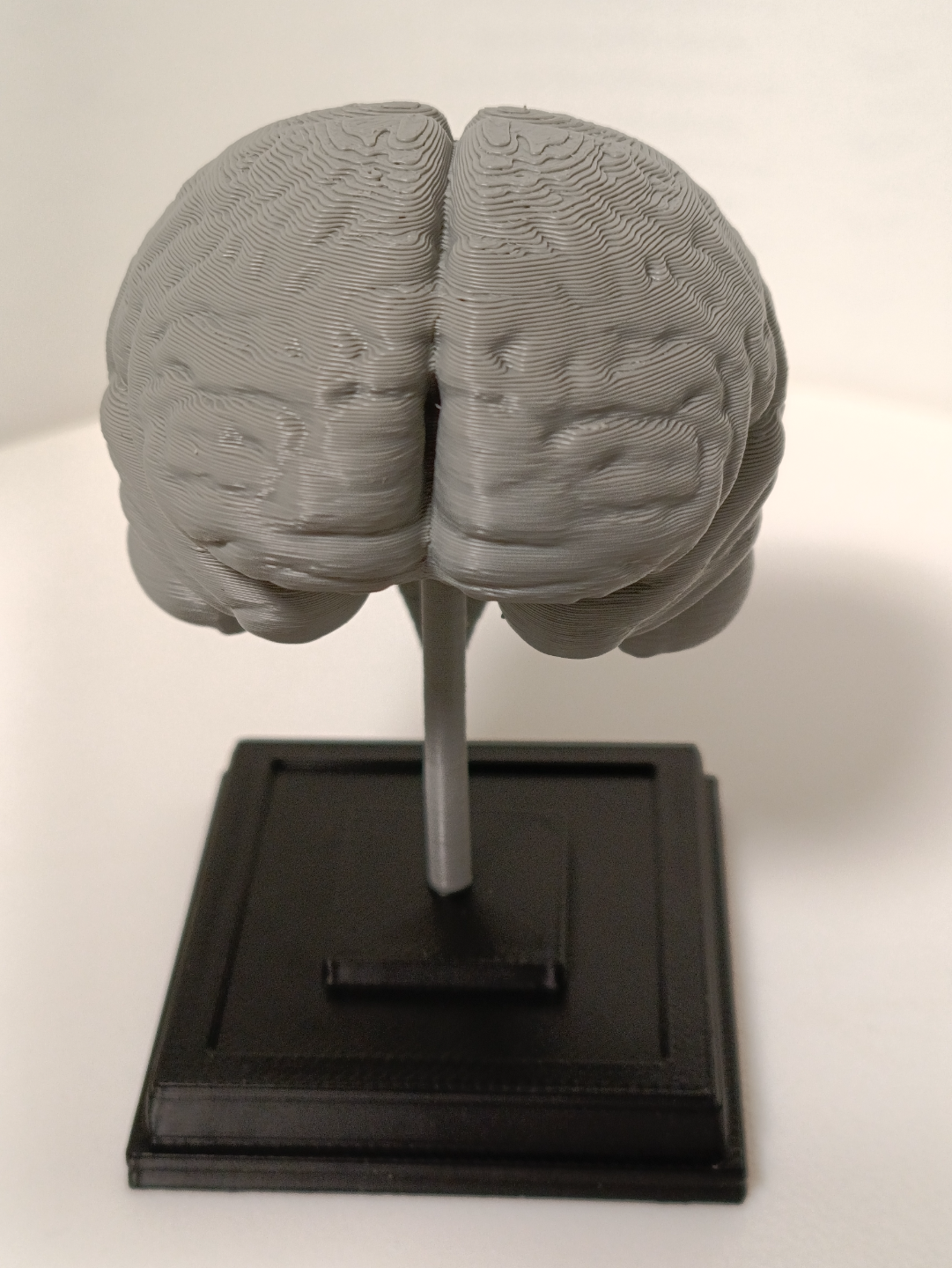 Brain on a stand